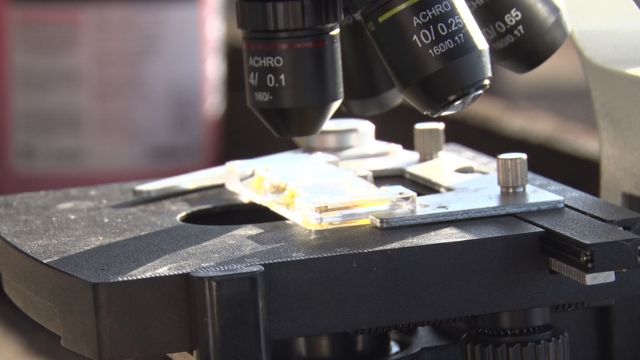 Microscópio agiliza a identificação de doenças provocadas por vermes em bovinos. Foto: Marco Ribeiro